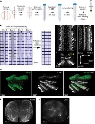 Passive Clearing and 3D Lightsheet Imaging of the Intact and Injured Spinal Cord in Mice